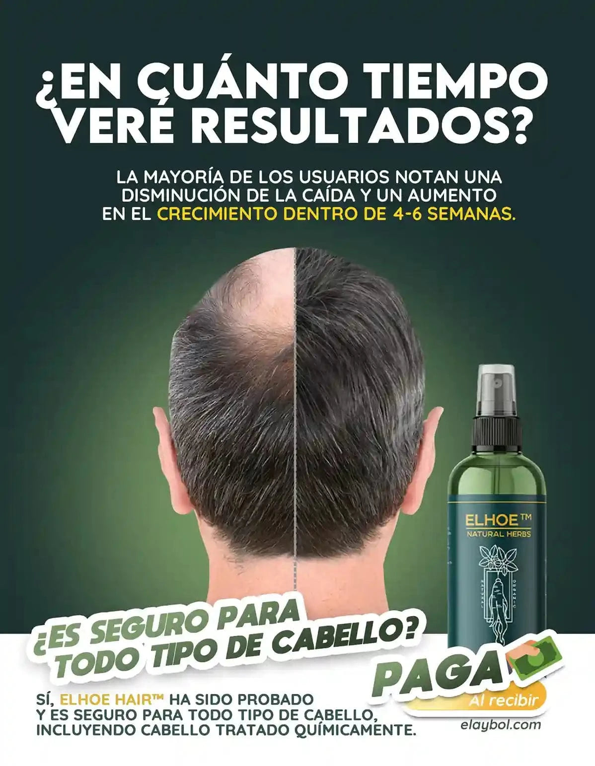 ELHOE HAIR™ – Suero Potenciador para el Crecimiento Capilar