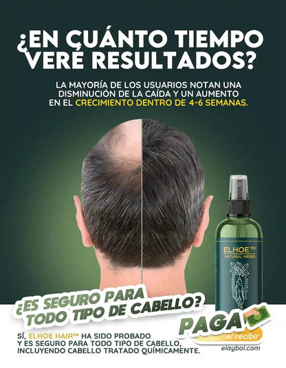 ELHOE HAIR™ – Suero Potenciador para el Crecimiento Capilar